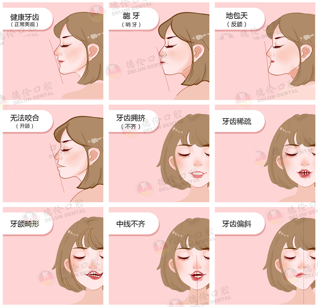 無牙模1 無牙模1