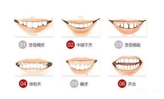 牙齒畸形