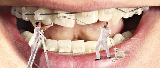 牙齒矯正